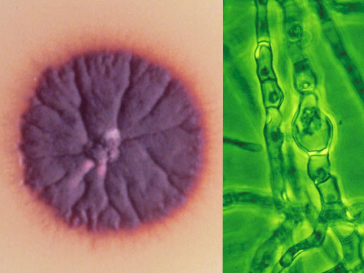 Trichophyton violaceum culture