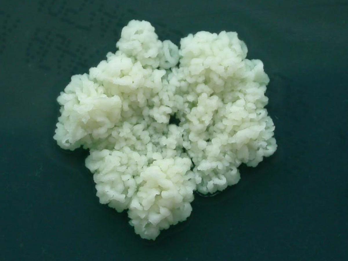 Trichosporon inkin culture