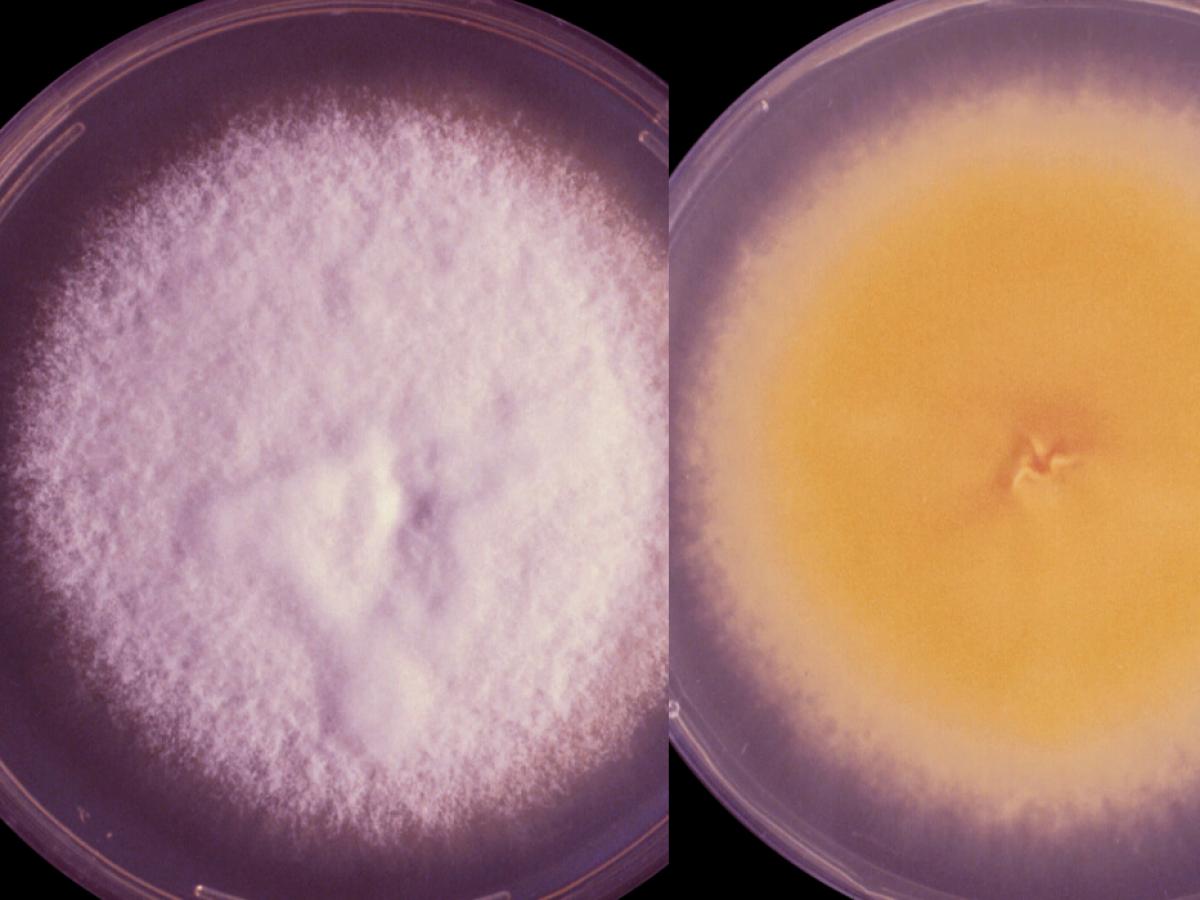 Trichophyton erinacei culture
