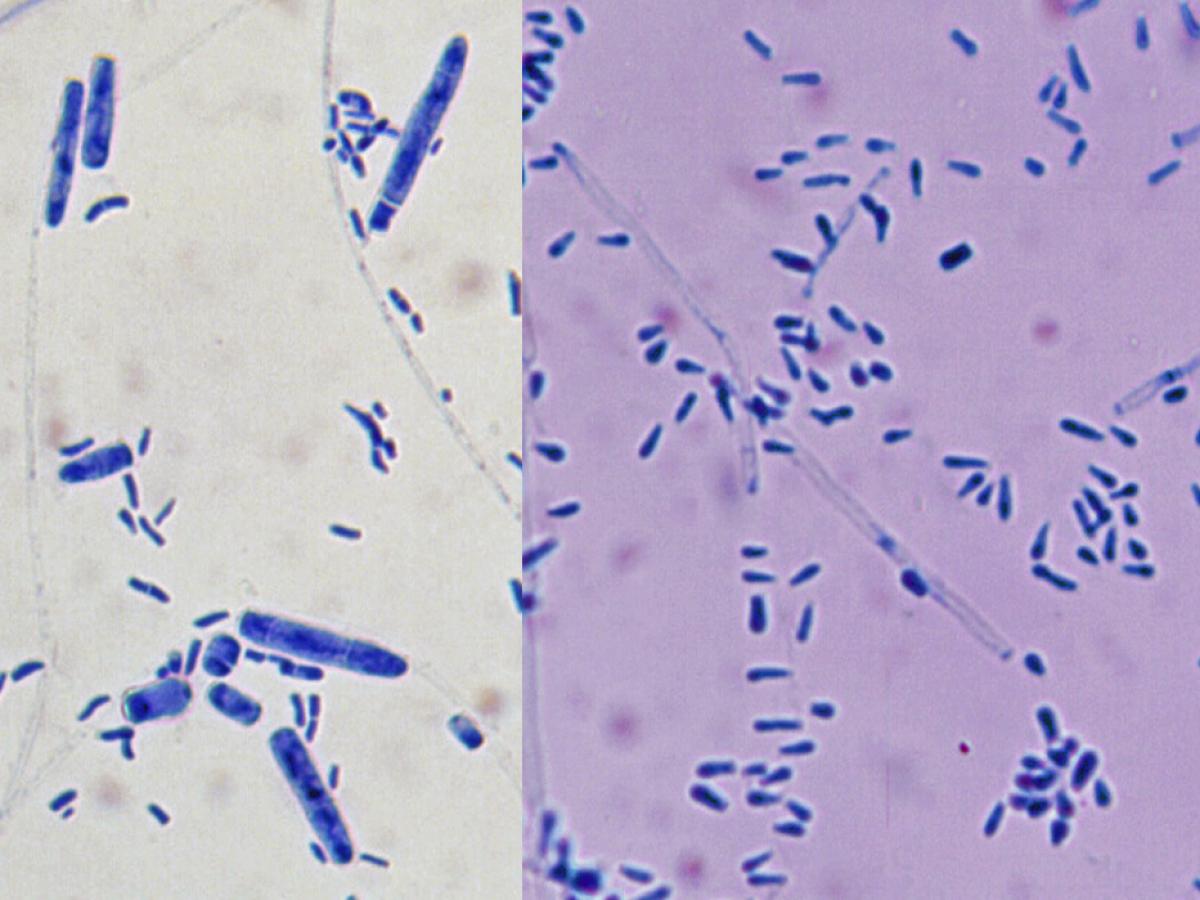 Trichophyton erinacei micro