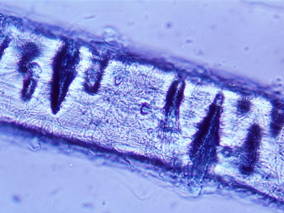 Trichophyton interdigital hair