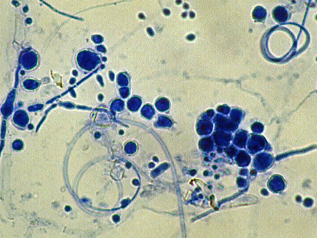 Trichophyton interdigital micro2