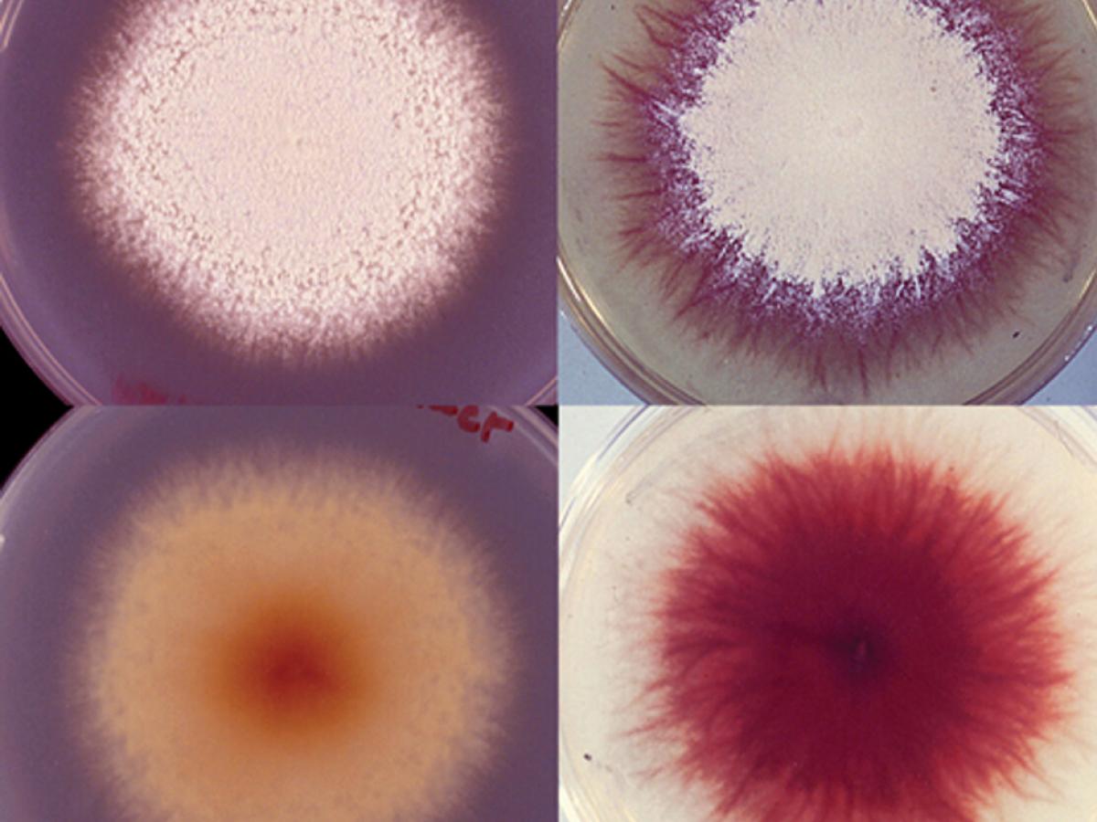 Trichophyton mentagrophytes culture
