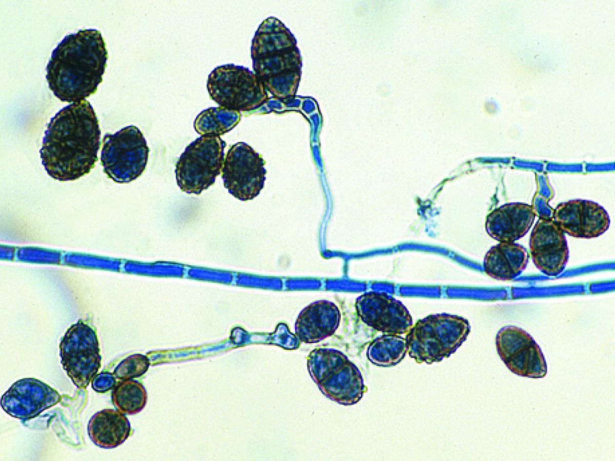Ulocladium