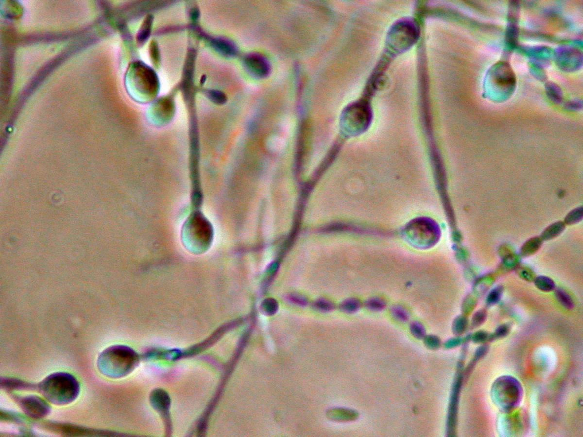 Unknown 01 microscopy 2
