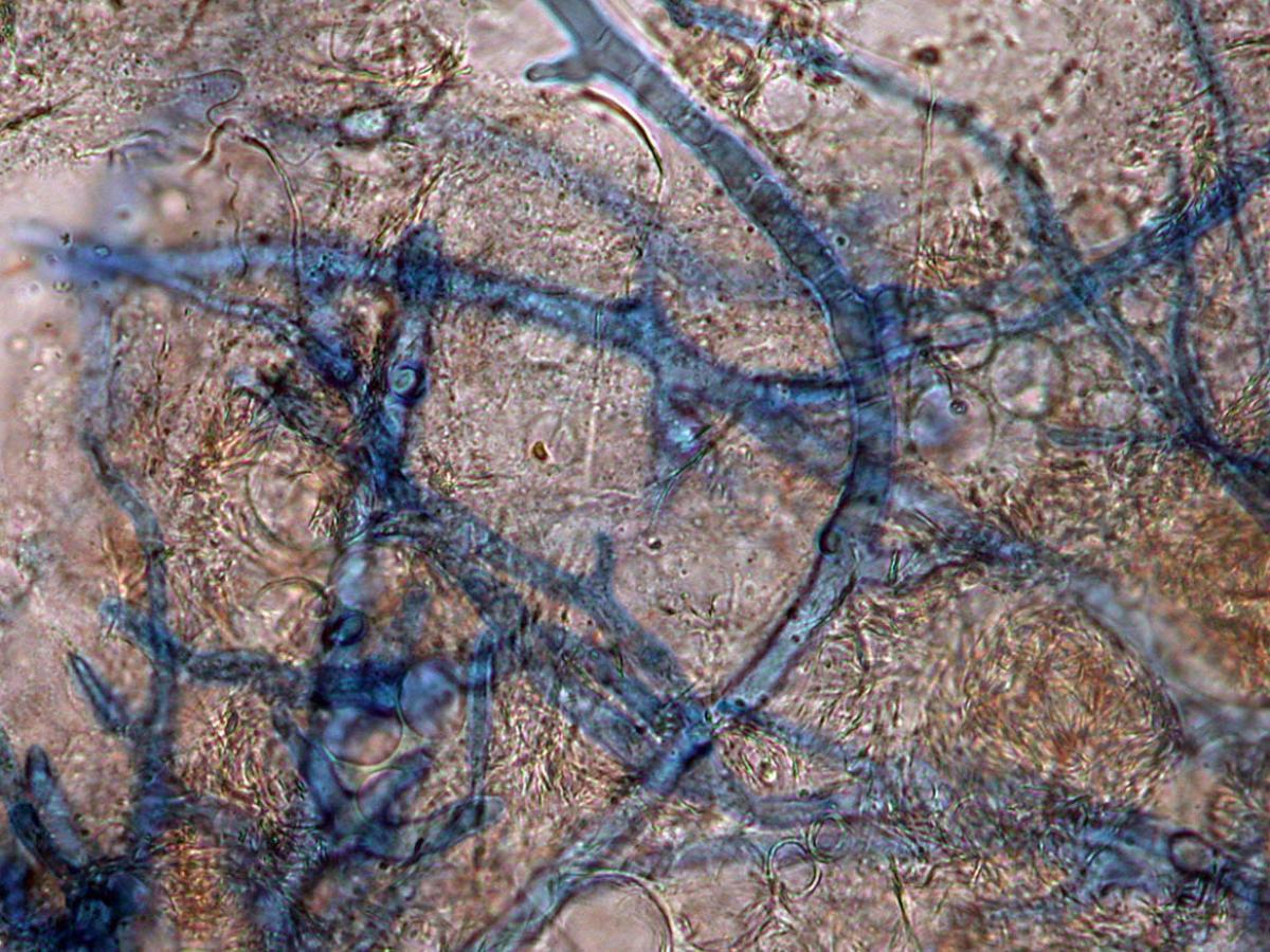 Unknown 12 Direct microscopy