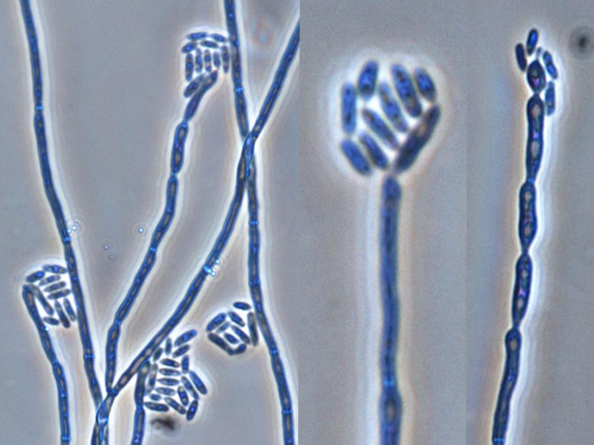 Unknown 18 microscopy