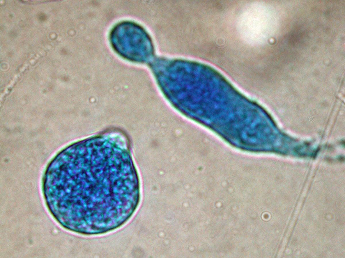 Unknown 19 microscopy - 3