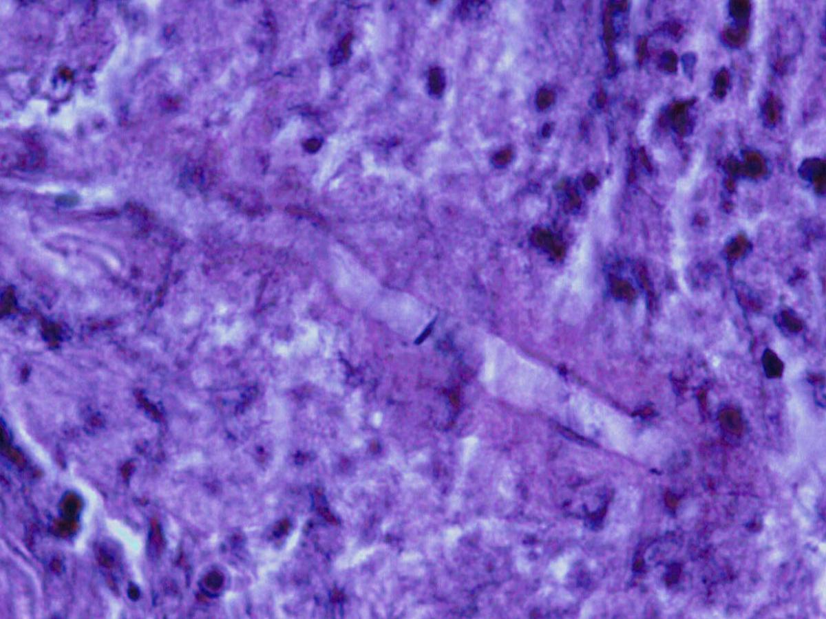 Unknown 02 histopathology