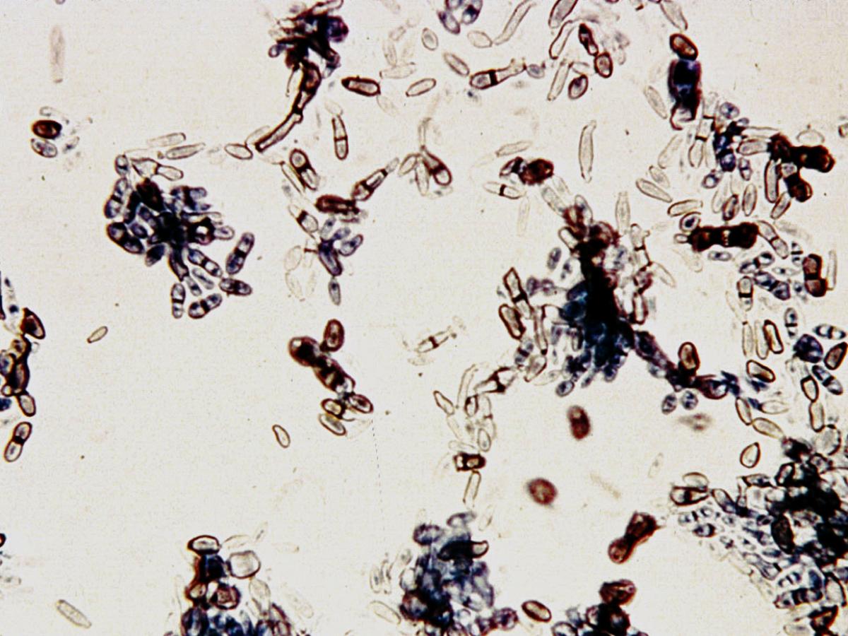 Unknown 22 direct microscopy