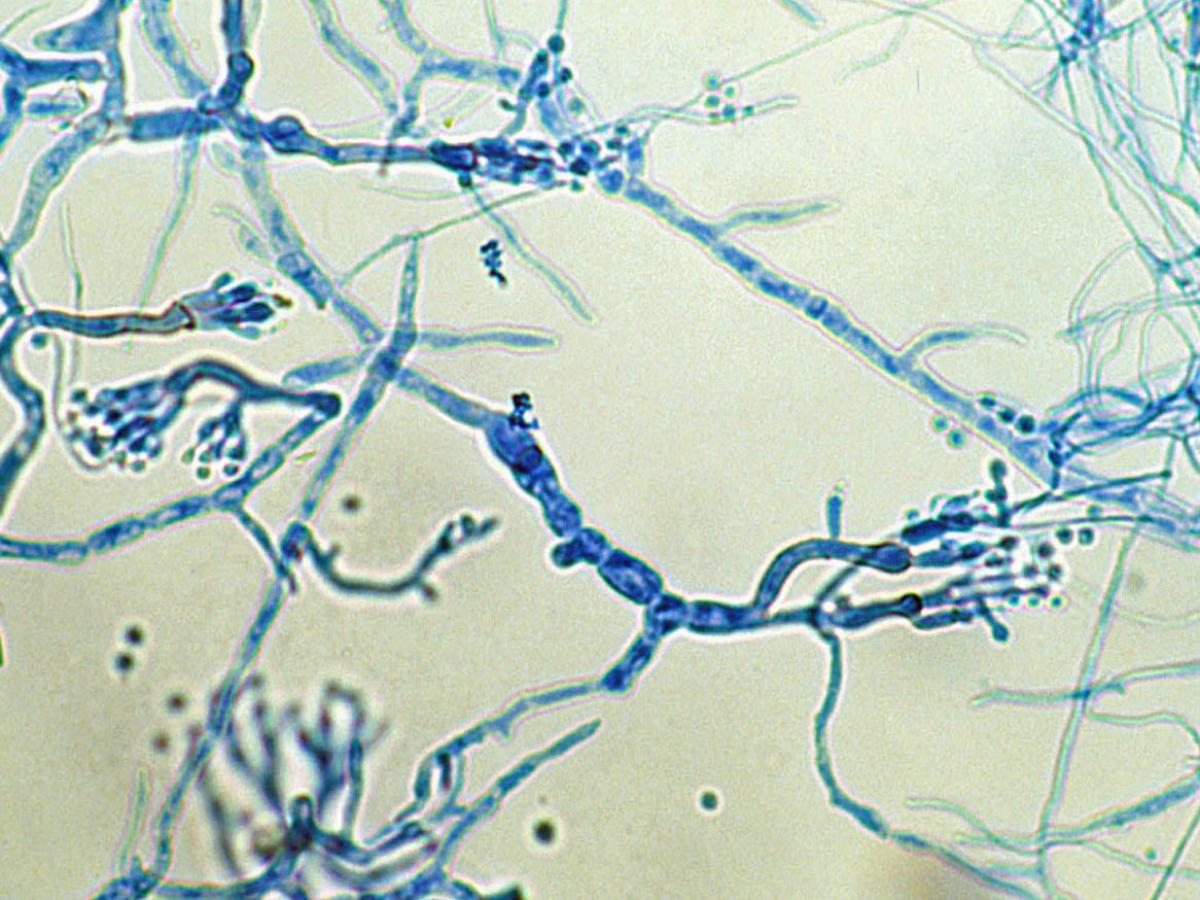 Unknown 26 microscopy