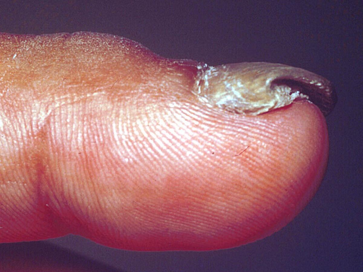 Unknown 27 clinical presentation