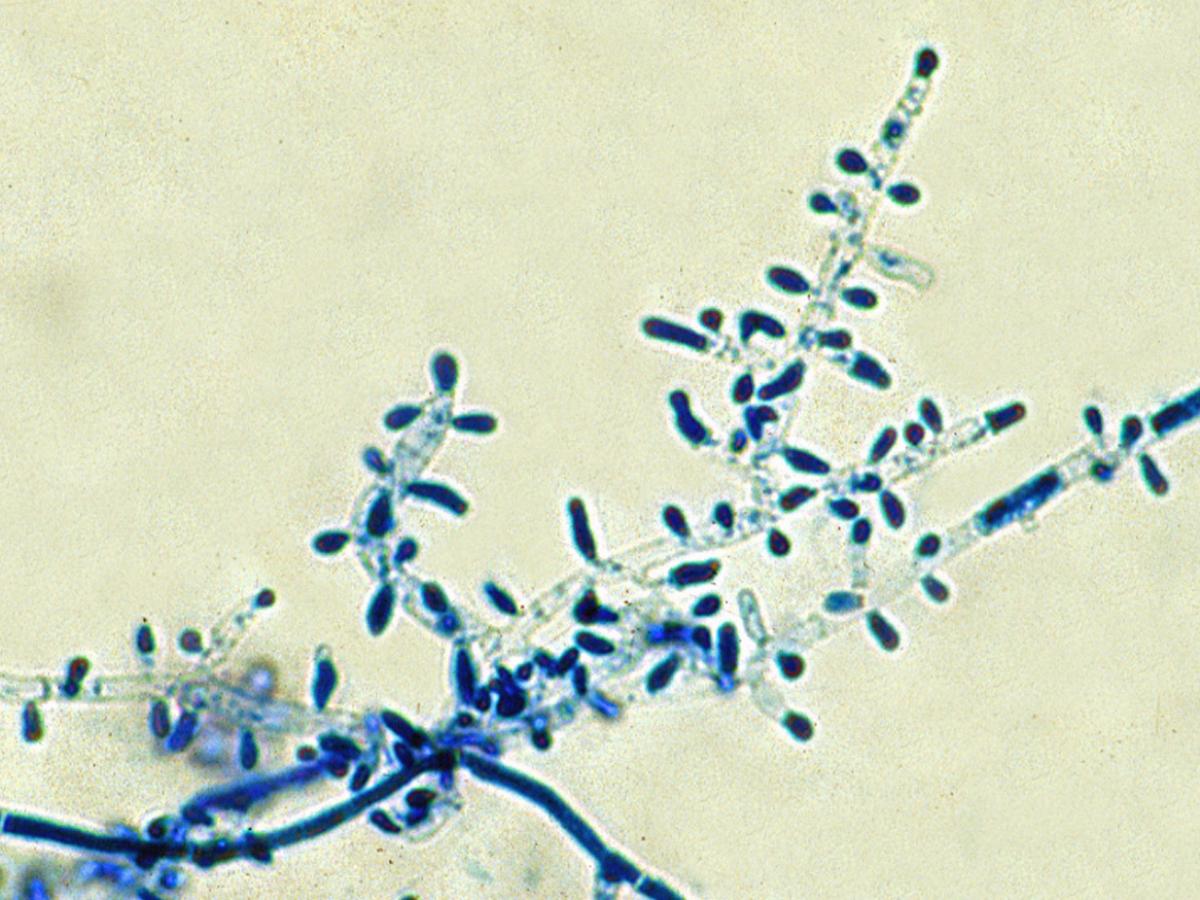 Unknown 27 microscopy - 1