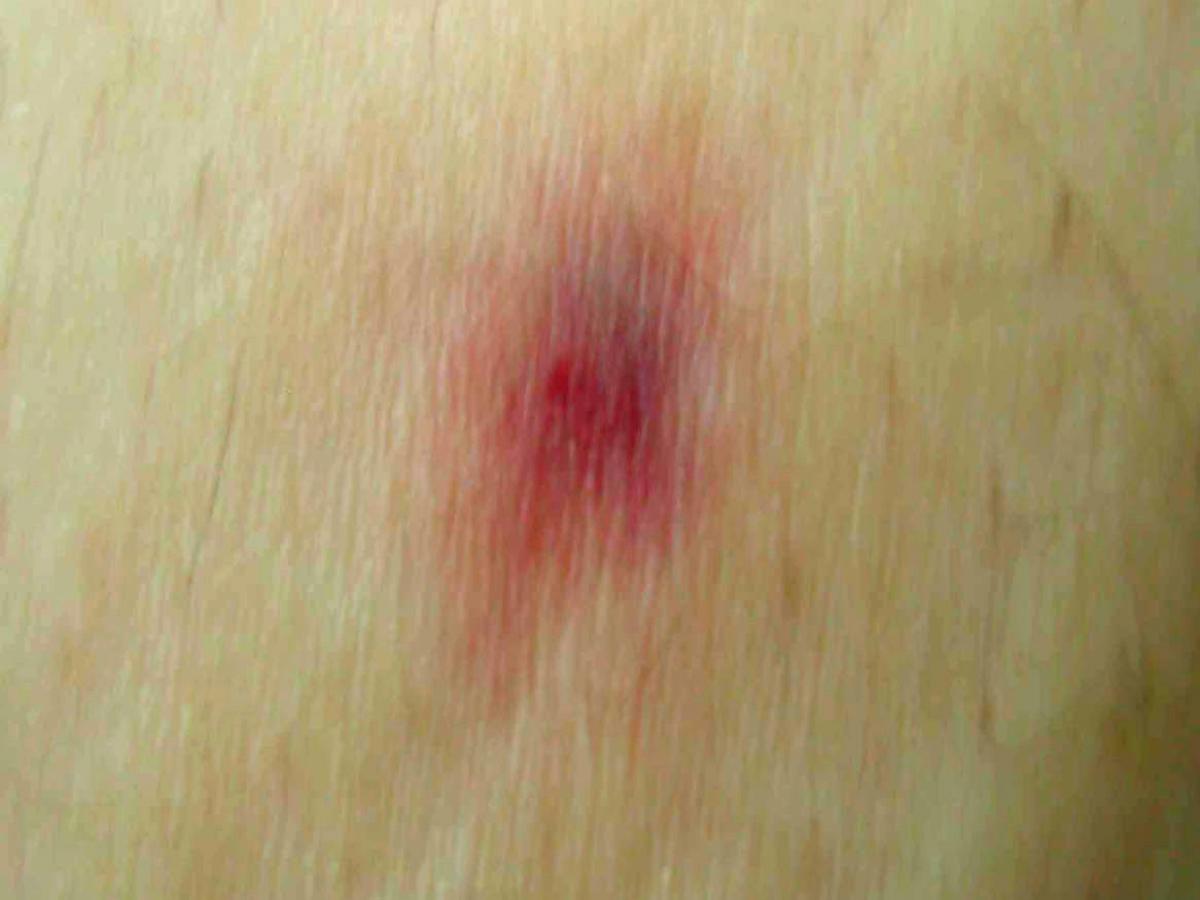 Clinical presentation