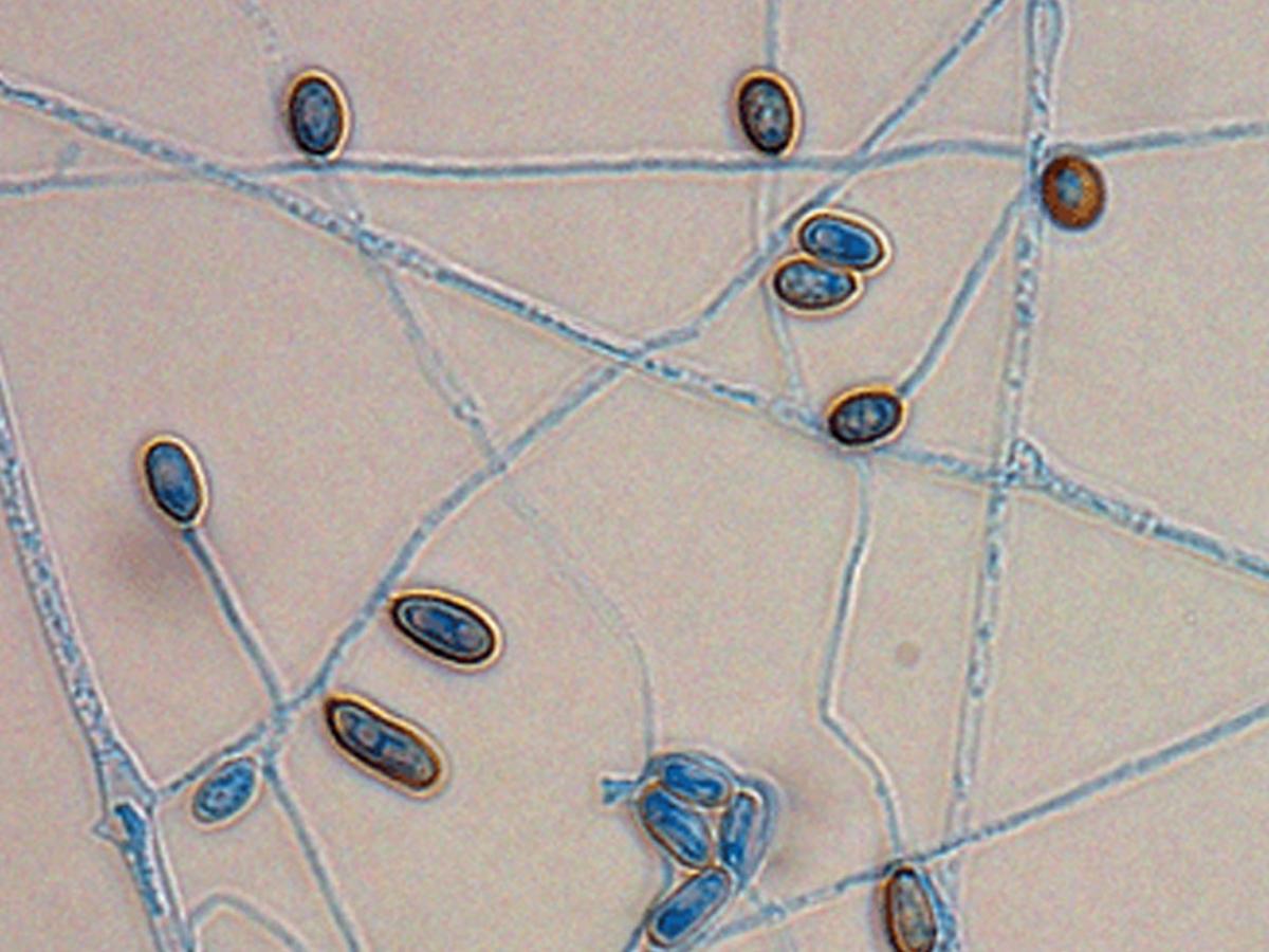 Unknown 30 microscopy - 1
