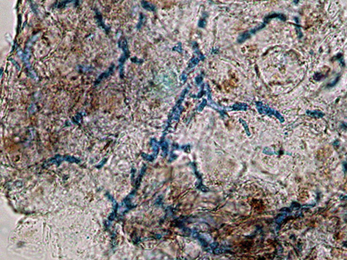 Unknown 31 direct microscopy (KOH Parker ink)