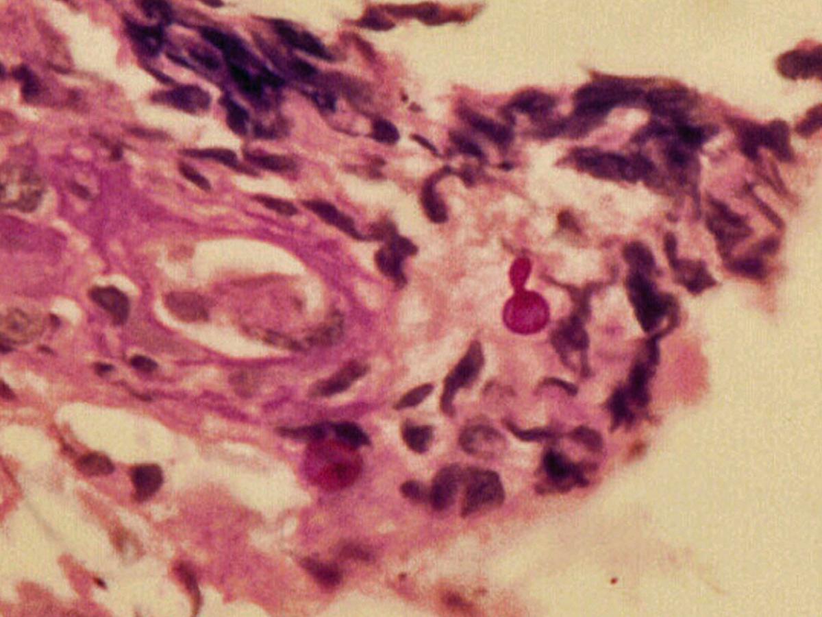 Histopathology