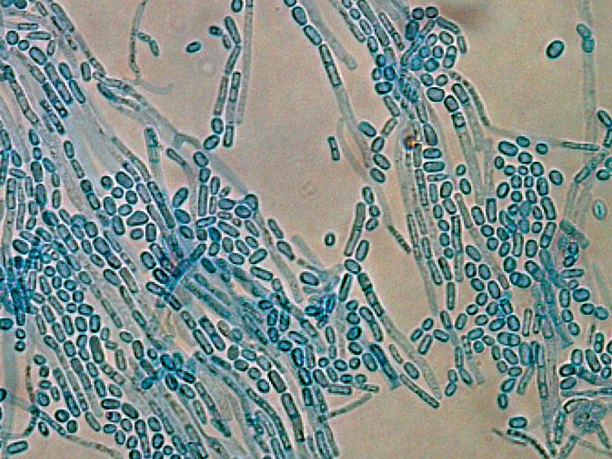 Unknown 36 microscopy