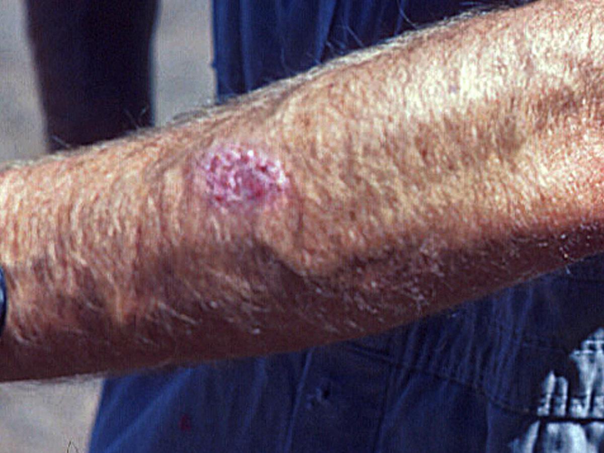 Unknown 38 clinical presentation
