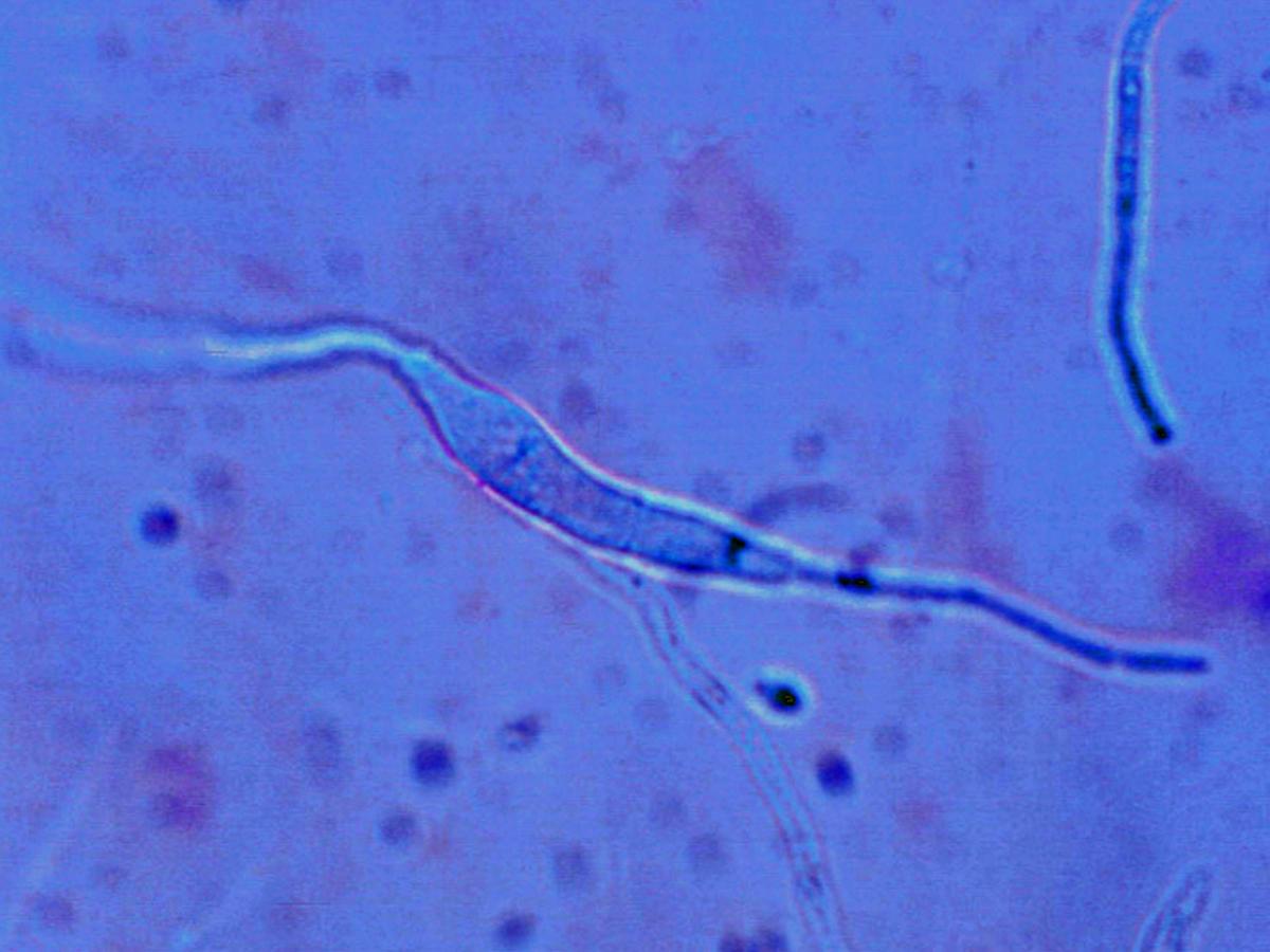 Unknown 38 microscopy - 3