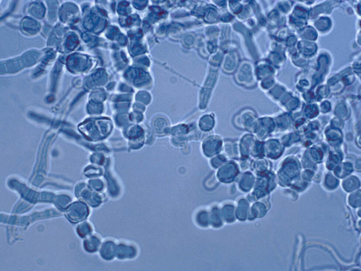 Unknown 38 microscopy - 4