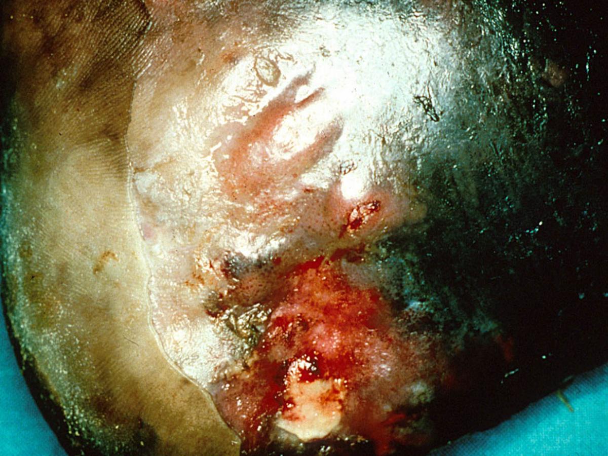 Clinical presentation