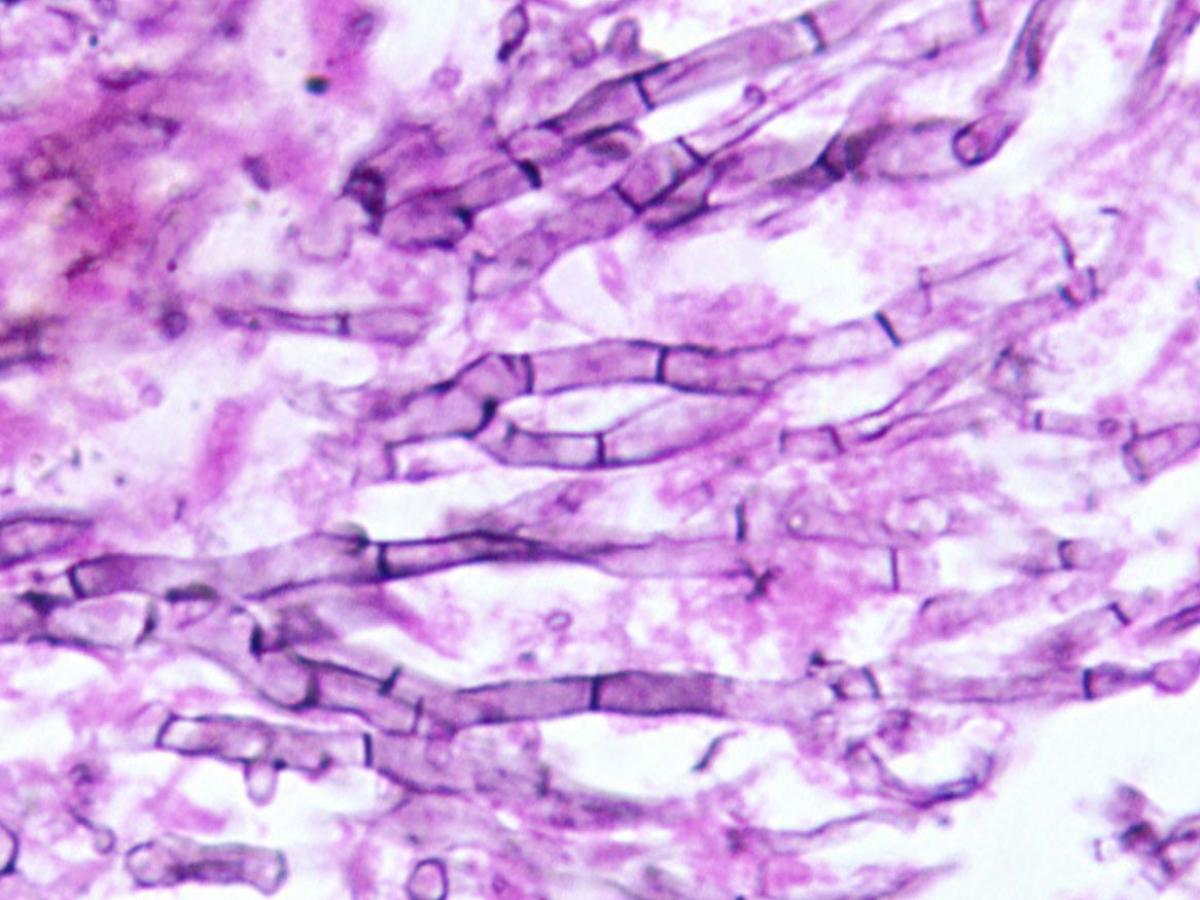 Unknown 41 direct microscopy - 2