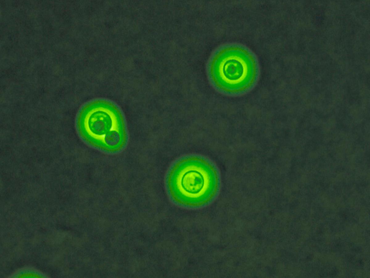 Unknown 44 microscopy