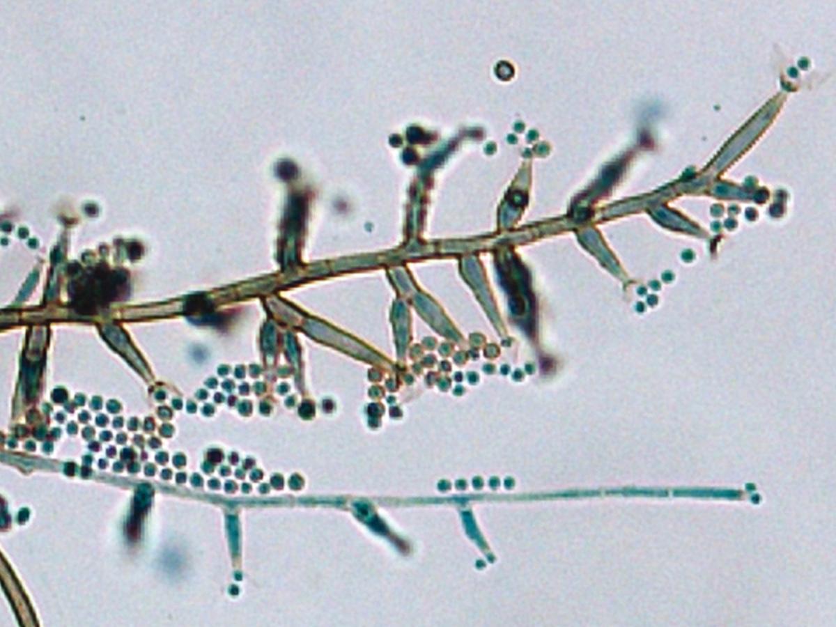 Unknown 45 microscopy - 2