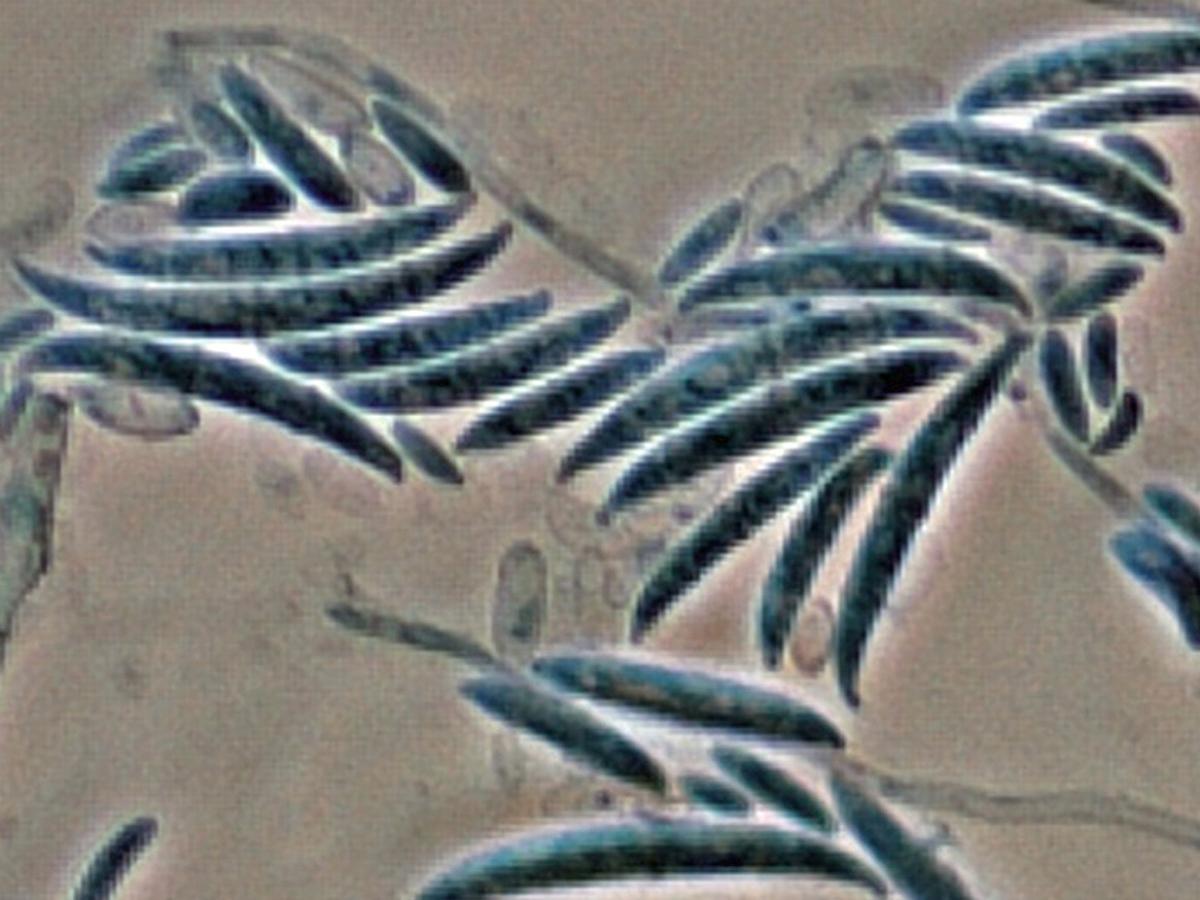 Unknown 46 microscopy - 1