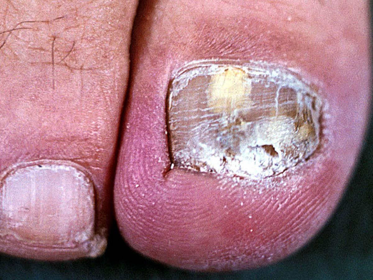 Unknown 49 clinical presentation