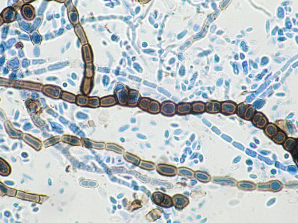 Unknown 58 microscopy - 1