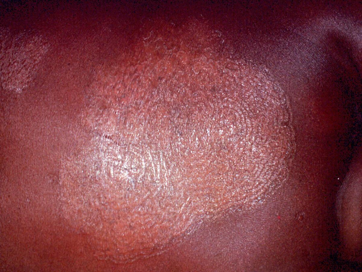 Clinical presentation