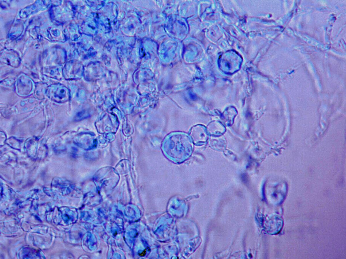 Unknown 59 microscopy