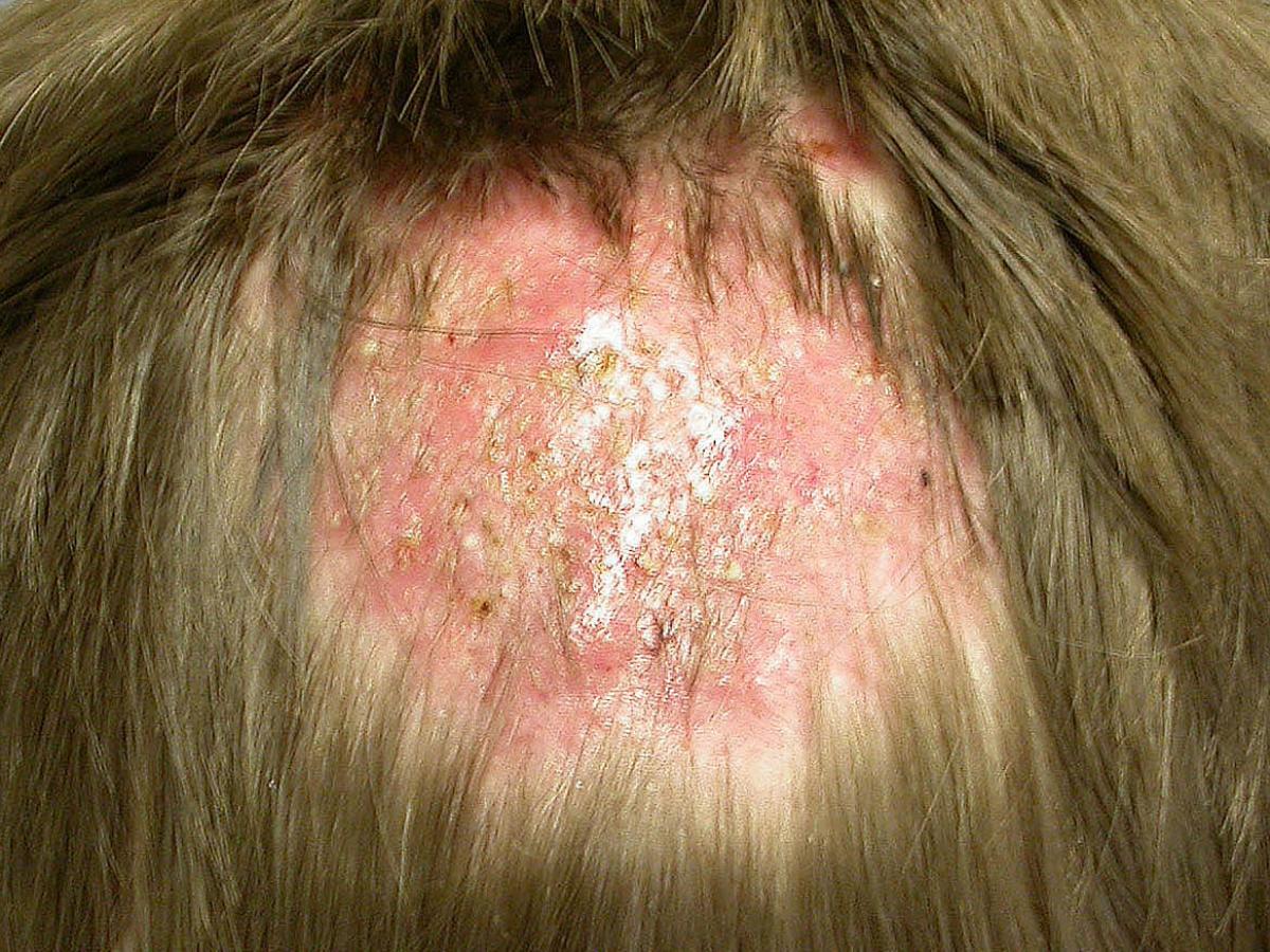 Clinical presentation