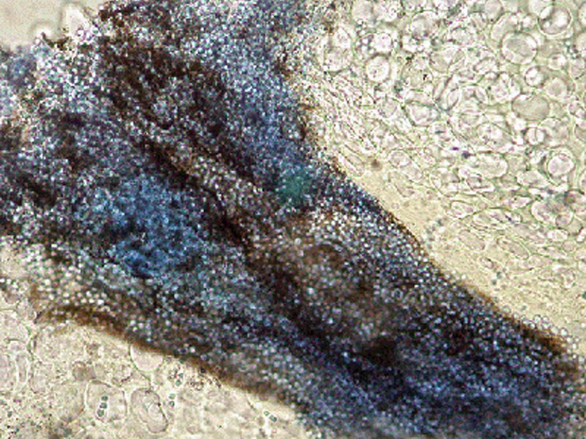 Direct microscopy of hair