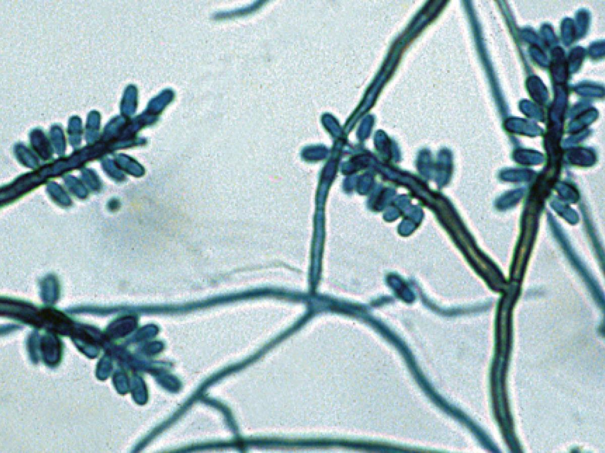 Veronaea