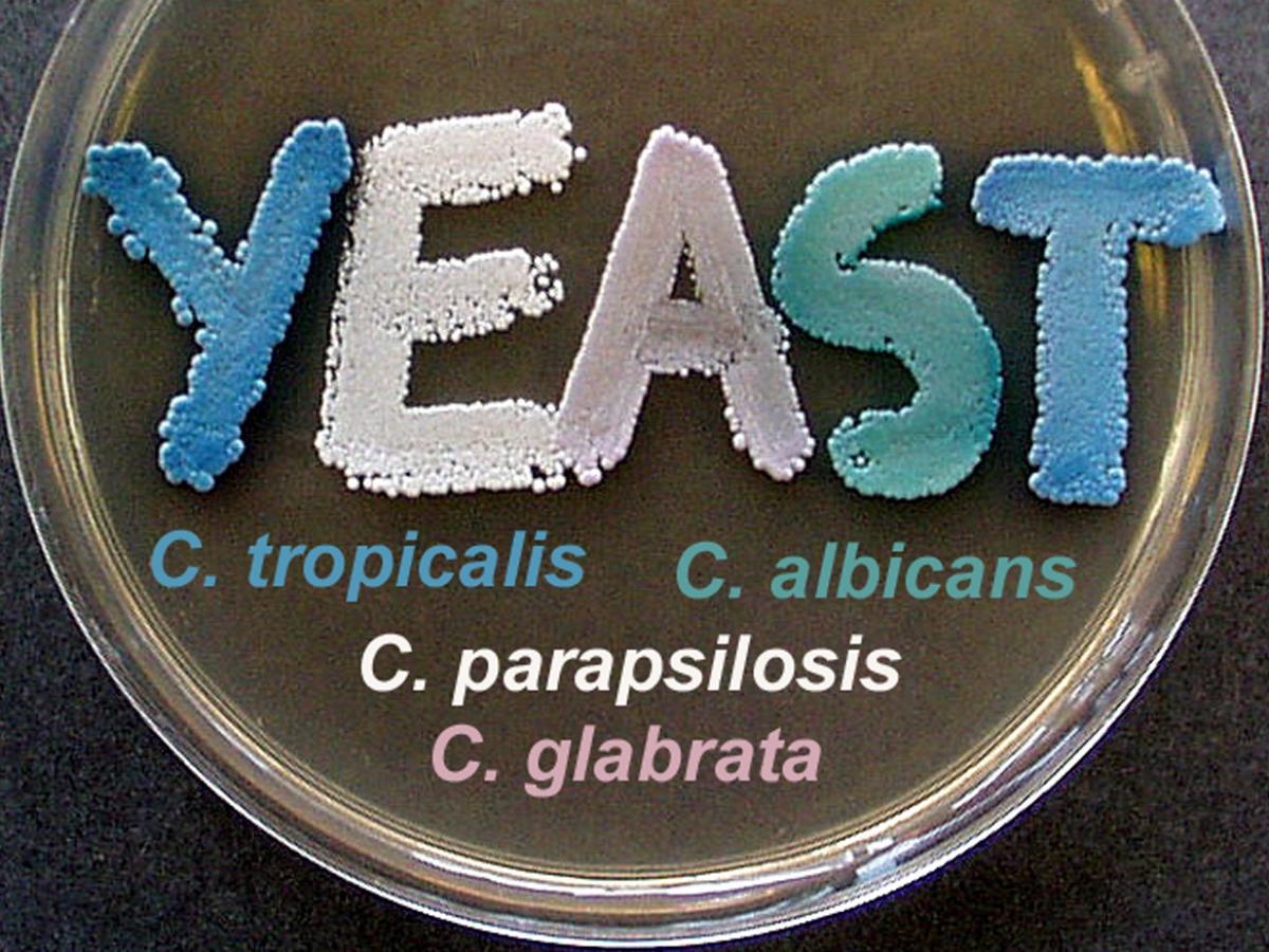 CHROMagar Candida