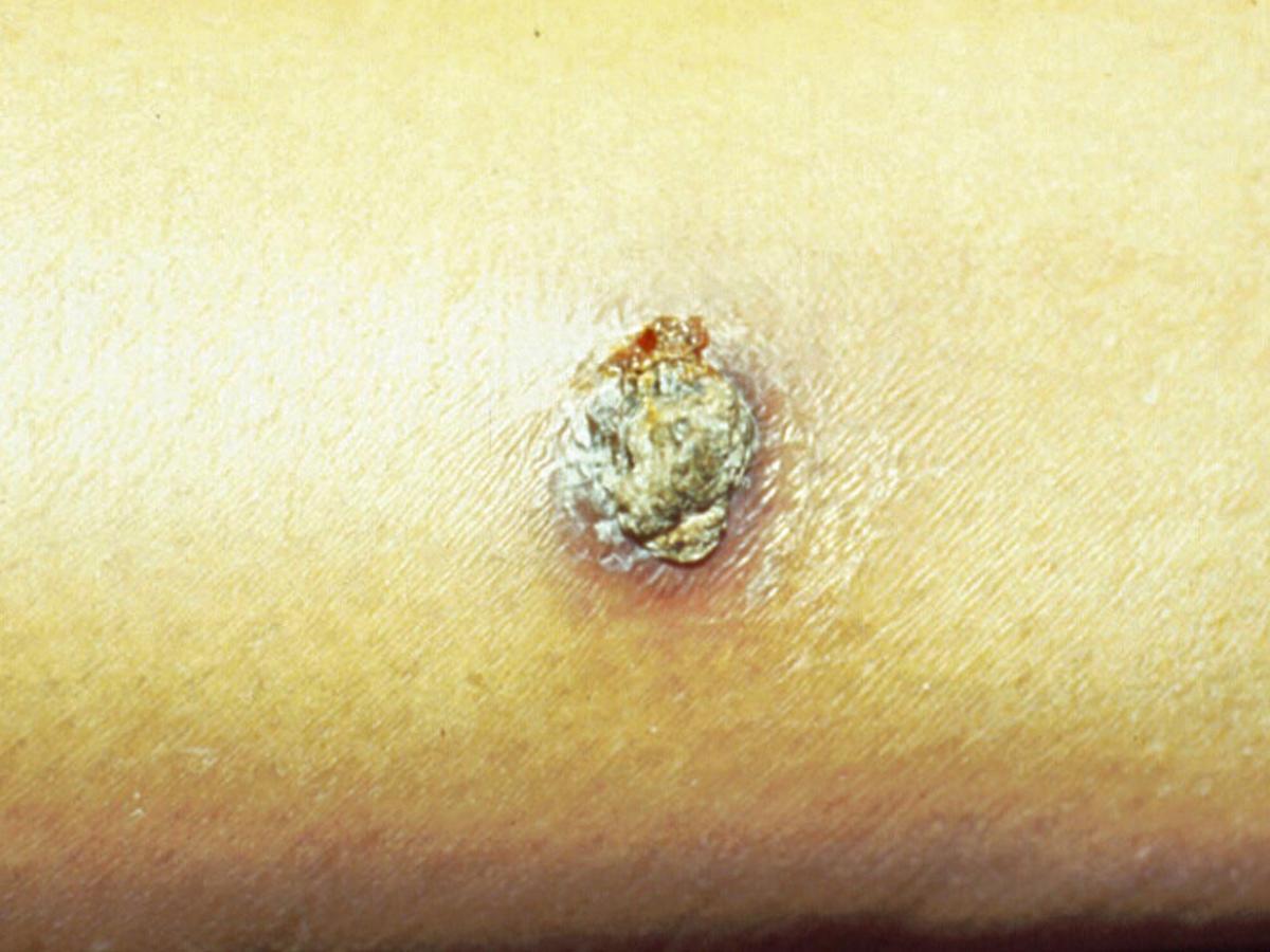 Unknown 62 clinical presentation