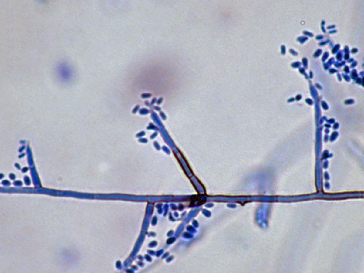 Unknown 62 microscopy