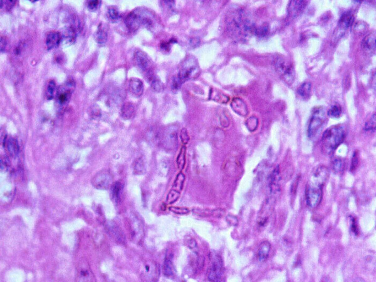 Unknown 64 histopathology