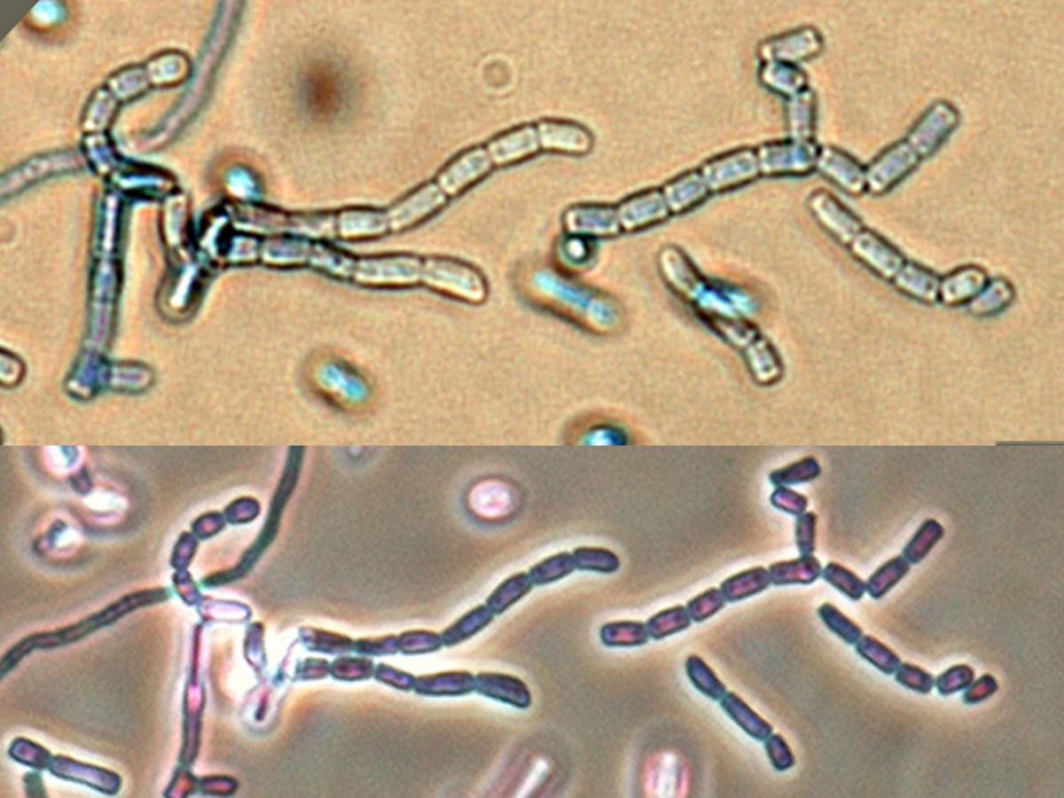 Unknown 65 microscopy