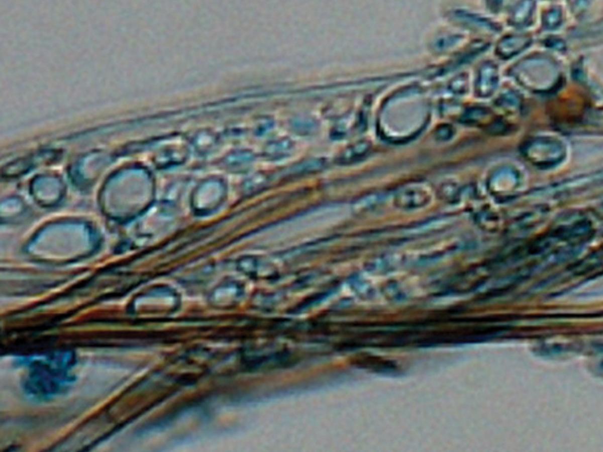 Unknown 67 microscopy - 1