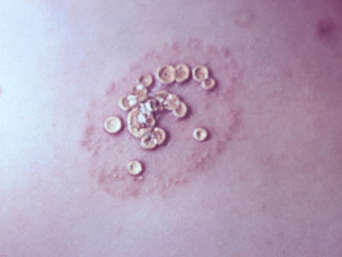 Unknown 70 clinical presentation