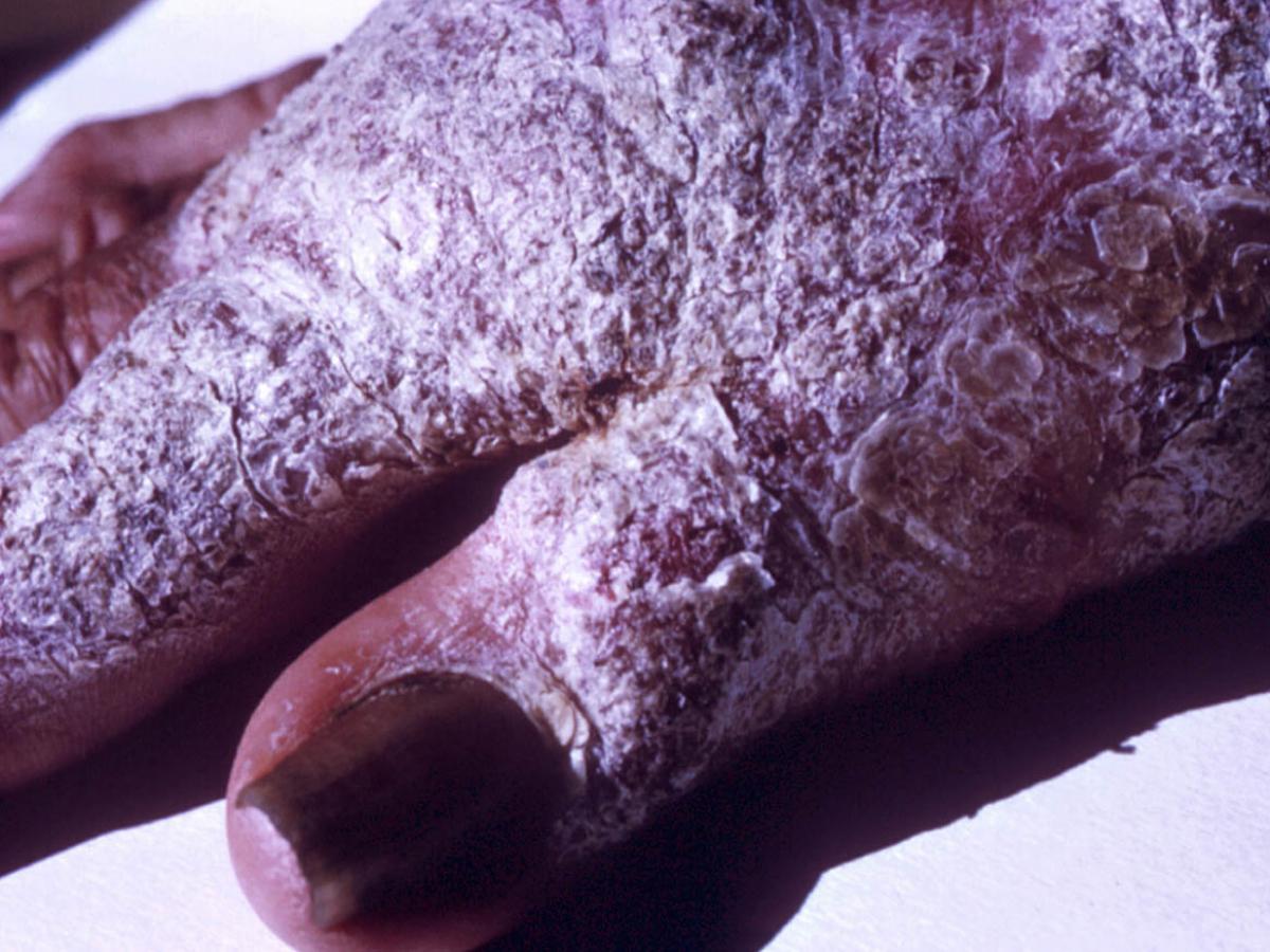 Clinical presentation