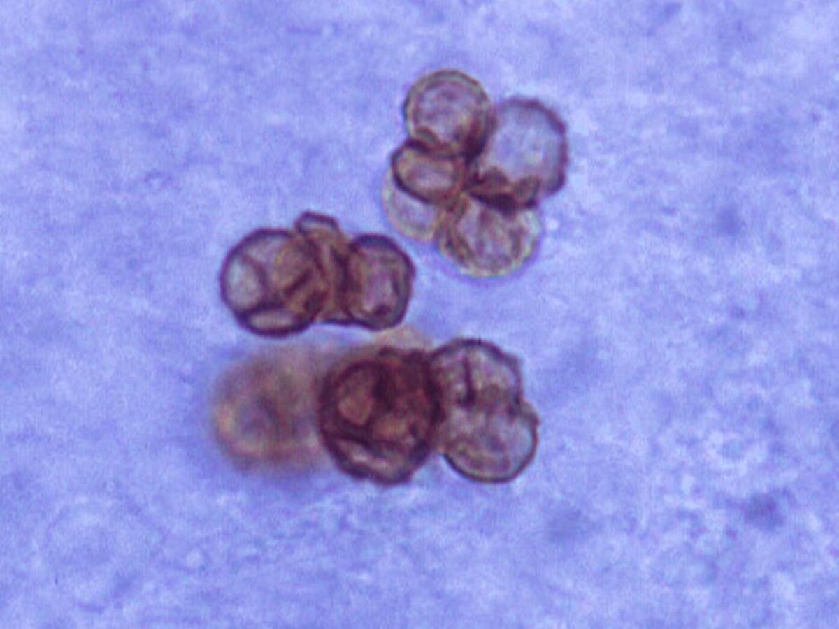 Unknown 74 direct microscopy
