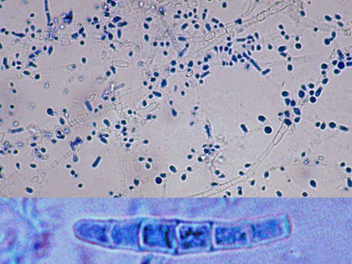 Unknown 79 microscopy