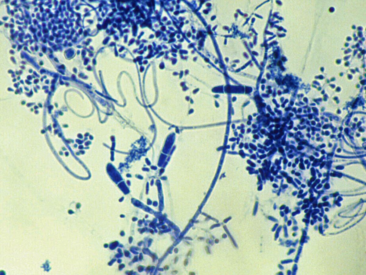 Unknown 80 microscopy - 2