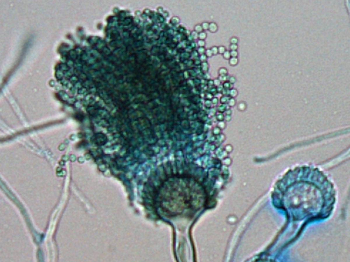 Unknown a microscopic morphology