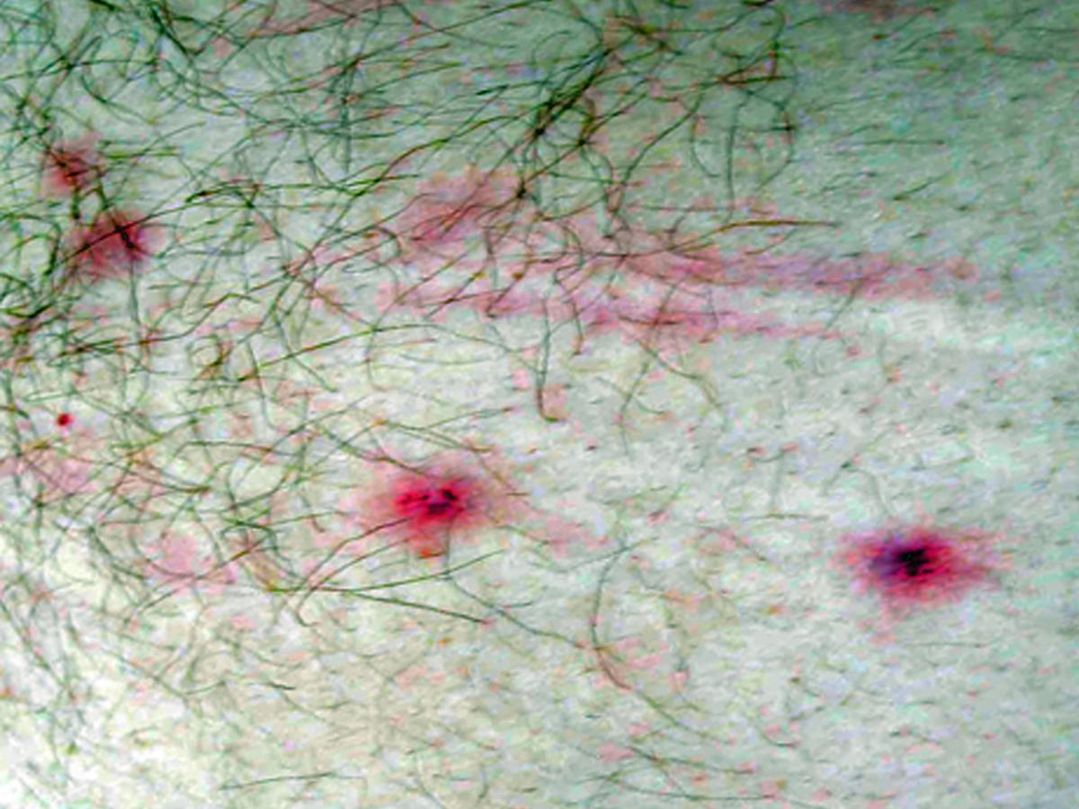 Unknown b clinical presentation